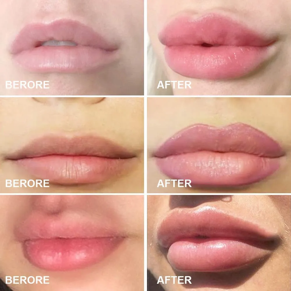 Lips Enhancer Plumper Device Lips Silicone Fish Shape Natural Pout Mouth Tool Sexy Lip Mouth